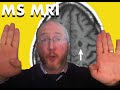 Answer Viewers Questions: Multiple Sclerosis MRI