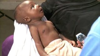 Breathing Problems - Newborn Care Series