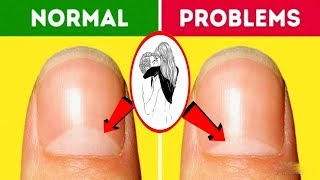 What is the meaning of half moon in your fingernails | ನಿಮ್ಮ ಉಗುರುಗಳು ನಿಮಗೆ ತಿಳಿಸುವ ರಹಸ್ಯಗಳು