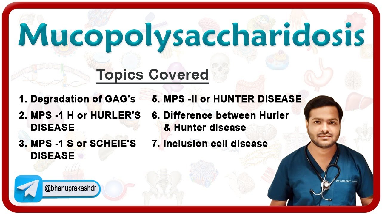 Mucopolysaccharidoses: Inherited Metabolic Disorders | MBBS ...