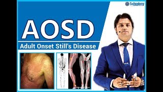 AOSD (Adult Onset Still's Disease) - Best Lecture for MRCP-2, MRCPCH