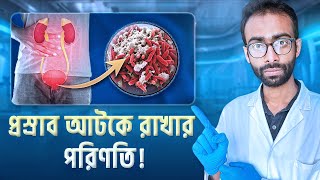 দীর্ঘ সময় প্রস্রাব আটকে রাখলে শরীরে যা ঘটে | Holding Pee: Risks and Effects | Sabbir Ahmed