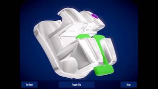 How to Open & Close EasyClip+® Brackets