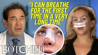 Two Botched Nose Job Leaves Bride-to-Be DESPERATE For A Fix | Botched | E!