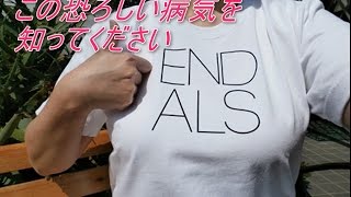 ALS! この難病を知ってください！