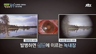 눈에 노화로 인해 실명을 부르는 3대 안질환 건강의 품격 33회