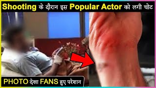 This Popular Actor Gets INJURED While Shooting, Shares Photo With Fans