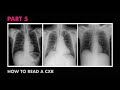 Assessment of CXR Quality - How to Read a Chest X-Ray (Part 5) - MEDZCOOL