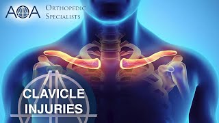 AOA Orthopedic Specialists - Clavicle Injuries