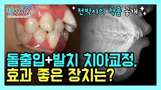 1-56. 입이 이렇게 돌출됐는데👀 \