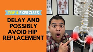 Top 4 Exercises To Delay And Possibly Avoid A Hip Replacement Surgery