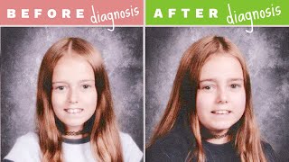 How I Got Diagnosed - Inflammatory Bowel Disease | Let's Talk IBD
