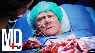 Eminent Doctor Requests Conscious Heart Surgery (Guest Star Malcolm McDowell) | Chicago Med | MD TV