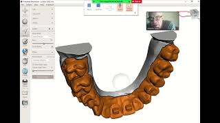 How to make a direct aligner in Meshmixer