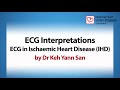 ECG Interpretations: ECG in Ischaemic Heart Disease (IHD) - Basic ECG March 2022