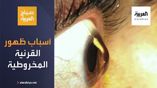 صباح العربية | ما أسباب ظهور القرنية المخروطية؟