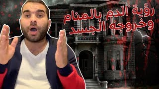 هل رأيت الدم في منامك من قبل إذا تعرف علي مايحدث لك بعد رؤيتة !!