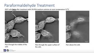 A study on effects of fixation with Formaldehyde and Paraformaldehyde