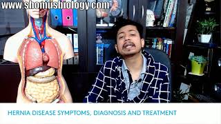 Hernia symptoms test diagnosis and surgery | Hernia kya hota hai Hindi mein