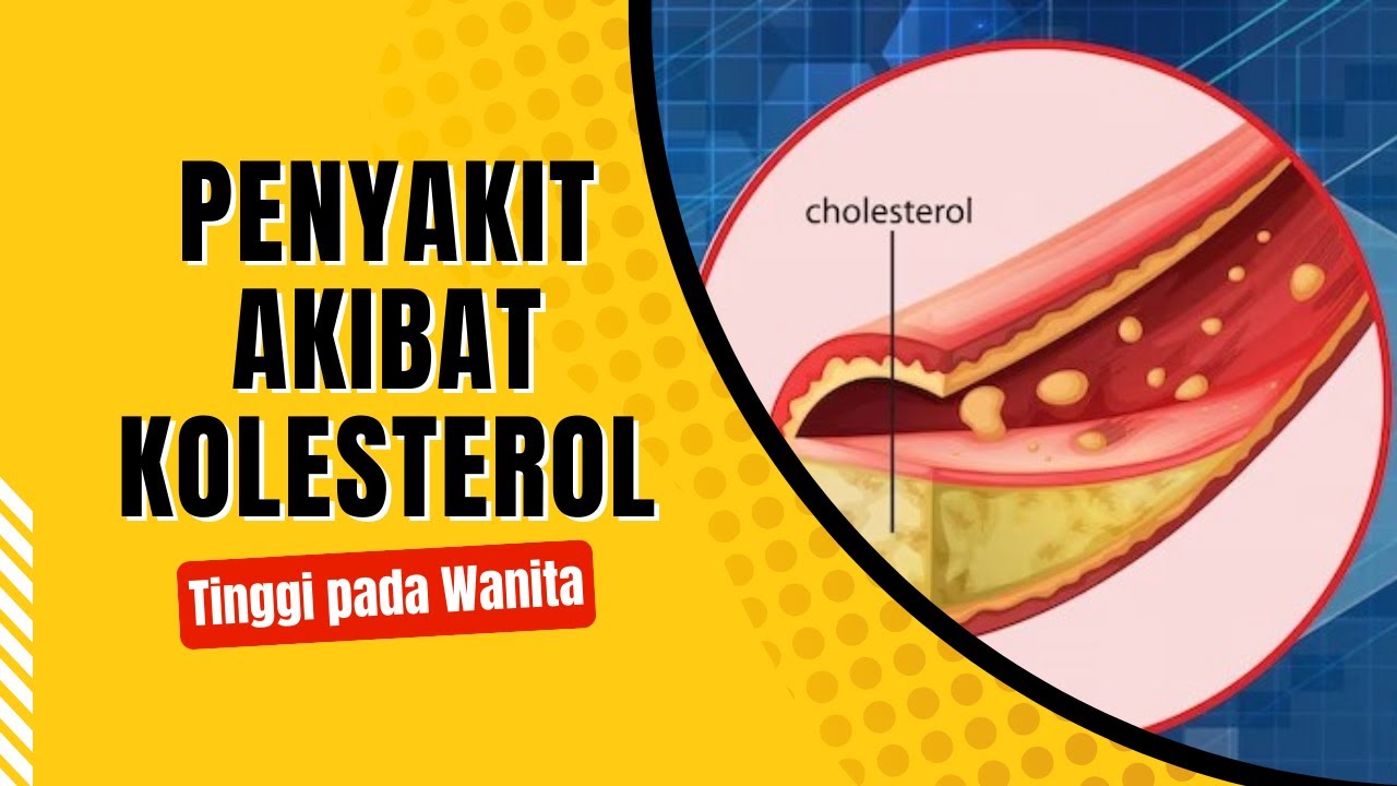 5 Penyakit Akibat Kolesterol Tinggi Pada Wanita - YouTube