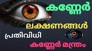 ദൃഷ്ടിദോഷം അഥവാ കണ്ണേർ എങ്ങനെ തിരിച്ചറിയാം, ഇതിനുള്ള പ്രതിവിധി#, മന്ത്രം  remedies for drishti dosha