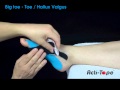 Acti-Tape - Big Toe - Toe / Hallux Valgus