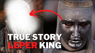 The True Story Of The Leper King- Baldwin IV