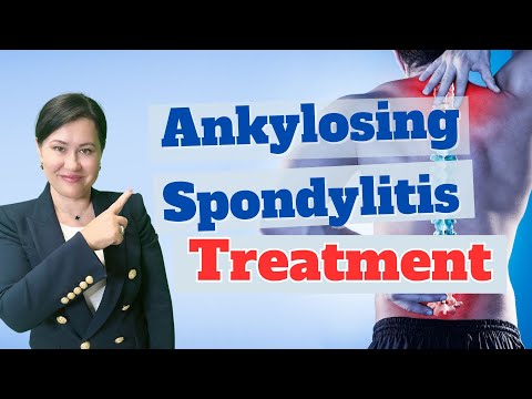What is the best treatment for spondyloarthritis?