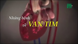 Những Bệnh về Van tim| VTC14