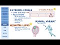 heart blocks pathology review