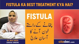 Fistula Ka Best Treatment Kya Hai - Bhagandar Ka Ilaj - What Is Peri-Anal Fistula - Fistula Symptoms