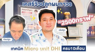 รีวิวปลูกผมถาวร 2500กราฟ 10เดือน ที่โฮร่าคลินิก