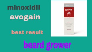 avogain using in 3months honest review(short clip)  #minoxidil#avogain#2021