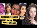 The secret weapon of Bollywood beauties | Does Gluthatione injection work for skin whitening