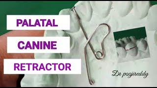 Palatal canine retractor|Palatal canine retractor fabrication |Dr poojireddy