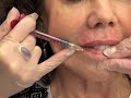 smooth stubborn lip lines juvederm volbella with. dr. julie russak