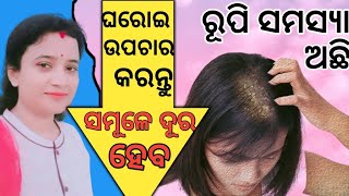 ରୂପି ସମସ୍ୟା ଦୂର କରିବାର ଘରୋଇ ଉପଚାର|ଘରୋଇ ଉପାୟ କରନ୍ତୁ ସମୂଳେ ଦୂର କରନ୍ତୁ