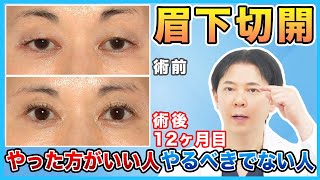 【目の上のたるみ】眉下切開法を受けるにあたり注意すべき人の特徴