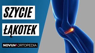 Metody szycia i rehabilitacja uszkodzonych łąkotek | Novum Ortopedia