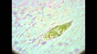 EUGLENOZOANS