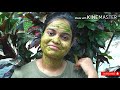 remove pimples pimple marks darkspots and acne marks naturally മുഖക്കുരുവും കറുത്ത പാടുകളും മാറാൻ💯