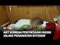 ART Korban Penganiayaan di Bandung Barat Jalani CT Scan | Kabar Petang tvOne