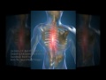 los gatos ca back pain relief dr. joseph leahy