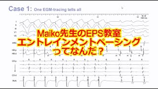 【EPS】Maiko先生のEPS教室　第１話　エントレインメントペーシングってなんだ？