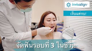 จัดฟันรอบที่ 3 ในชีวิต กับการดัดฟันแบบใส Invisalign