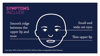 #DRYMESTER FASD The Signs and Symptoms