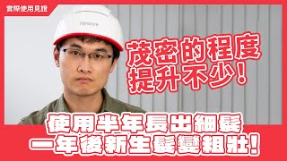 iRestore雷射生髮帽《實際使用心得見證》邱先生因有壞死的毛囊，植髮後持續使用雷射生髮帽，連醫生都說恢復得很好！