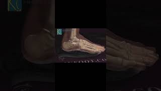 How to repair flat feet?