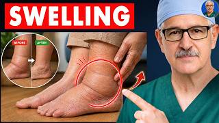 Surgeon Reveals: THIS 1 Simple Movement to Eliminate Swollen Legs and Ankles | Senior Health