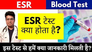 ESR टेस्ट क्या होता है |  इस टेस्ट से हमें क्या जानकारी मिलती है | ESR के नॉर्मल वैल्यूज क्या हैं?